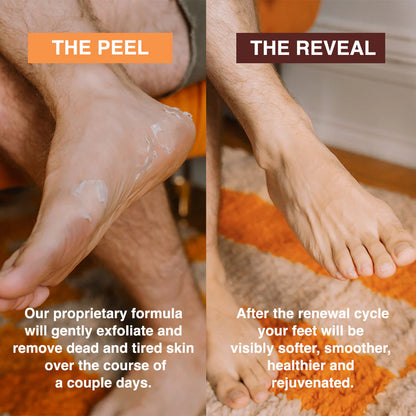 SeoulSkin Glycolic Acid Foot Peeling Mask (1 Pair), Korean Peeling & Exfoliating | Deep Exfoliation with Glycolic Acid, Removes Dead Skin, Cruelty-Free, Foot Peel Off Mask