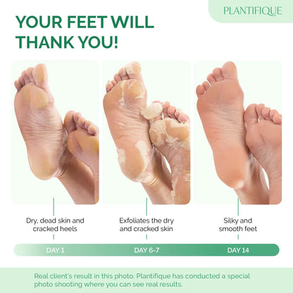 SeoulSkin Glycolic Acid Foot Peeling Mask (1 Pair), Korean Peeling & Exfoliating | Deep Exfoliation with Glycolic Acid, Removes Dead Skin, Cruelty-Free, Foot Peel Off Mask